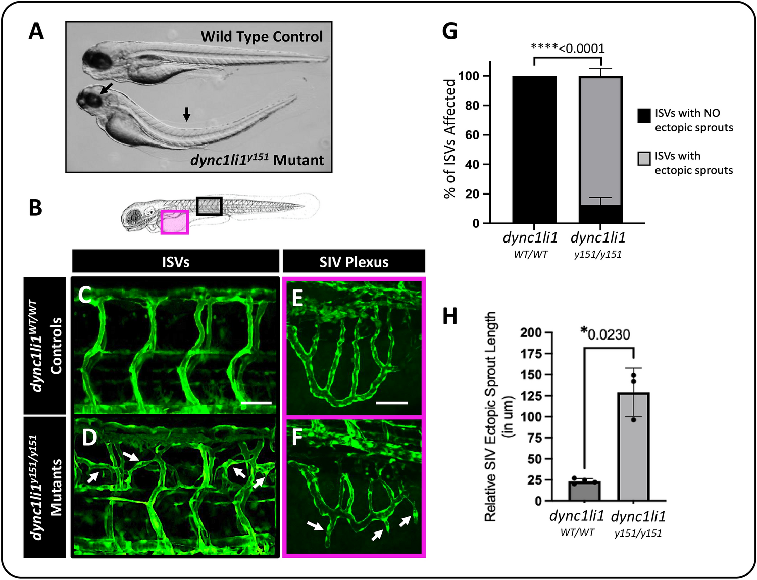 Angiogenesis is limited by LIC1-mediated lysosomal trafficking