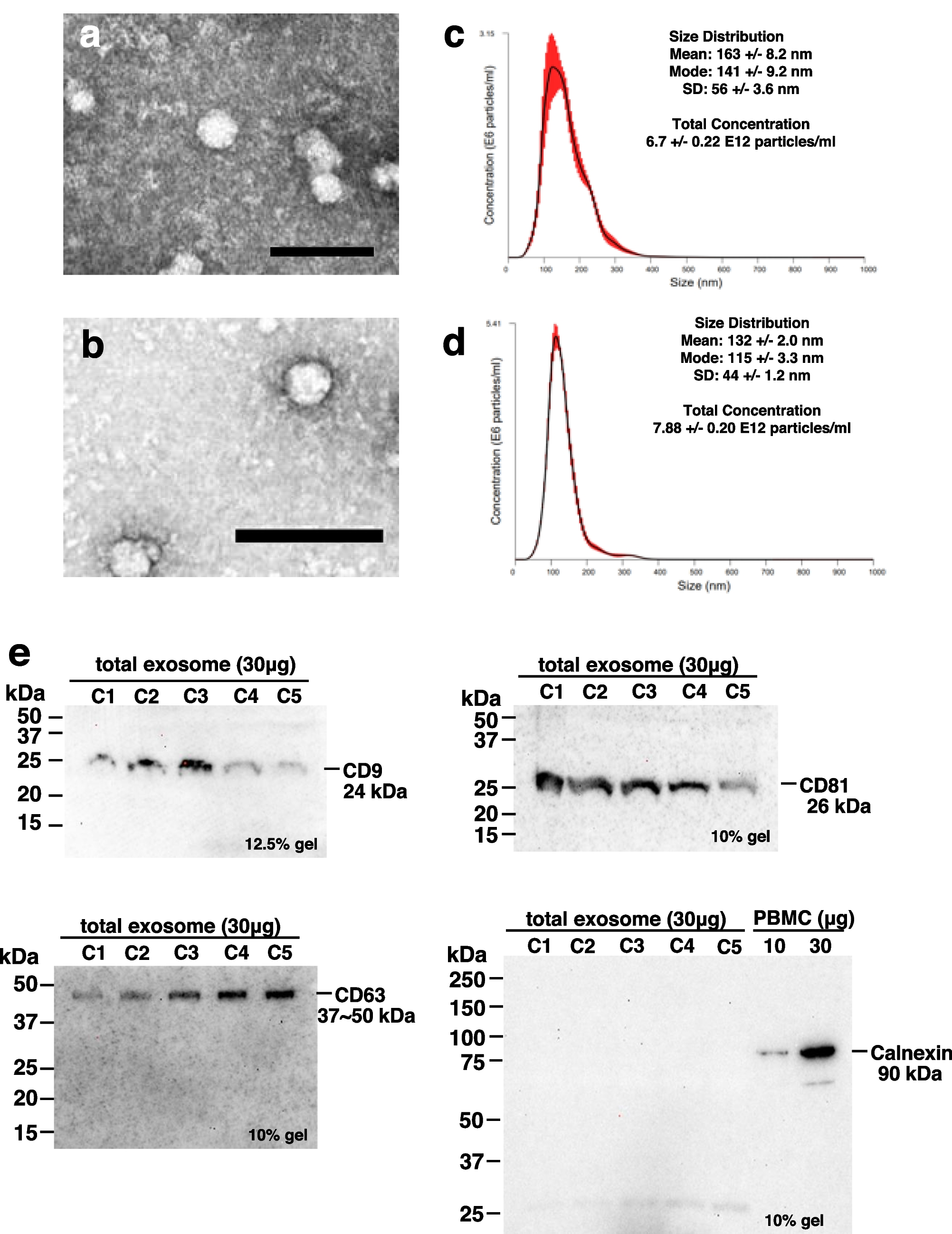 MicroRNA in neuroexosome as a potential biomarker for HIV-associated neurocognitive disorders