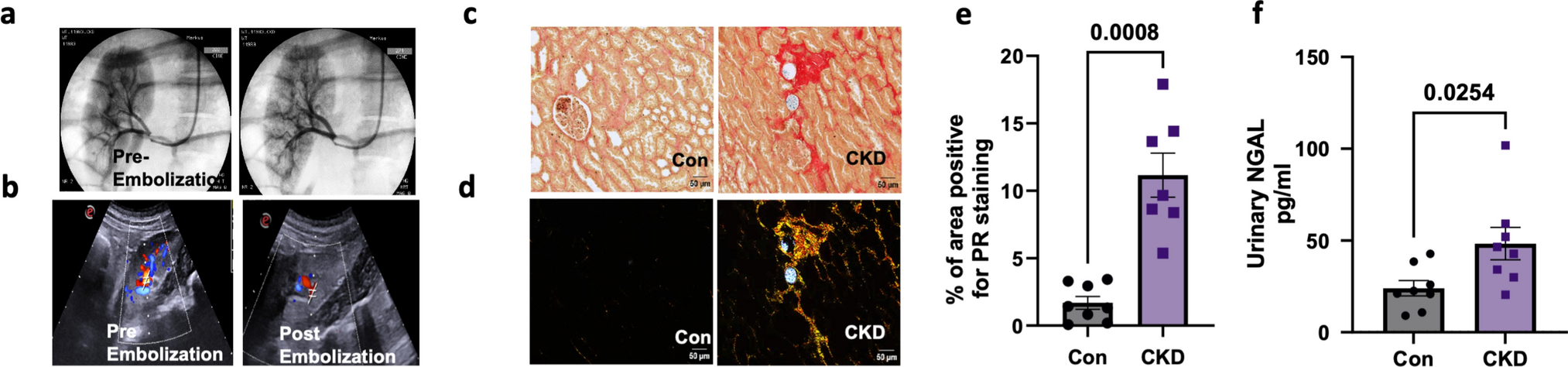 Oxidative stress initiates hemodynamic change in CKD-induced heart disease