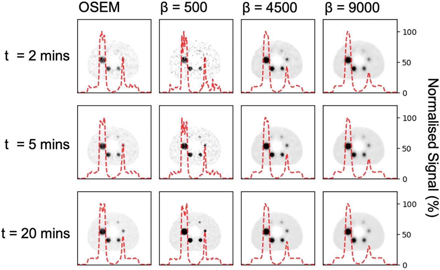 Phantom-based investigation of block sequential regularised expectation maximisation (BSREM) reconstruction for zirconium-89 PET-CT for varied count levels