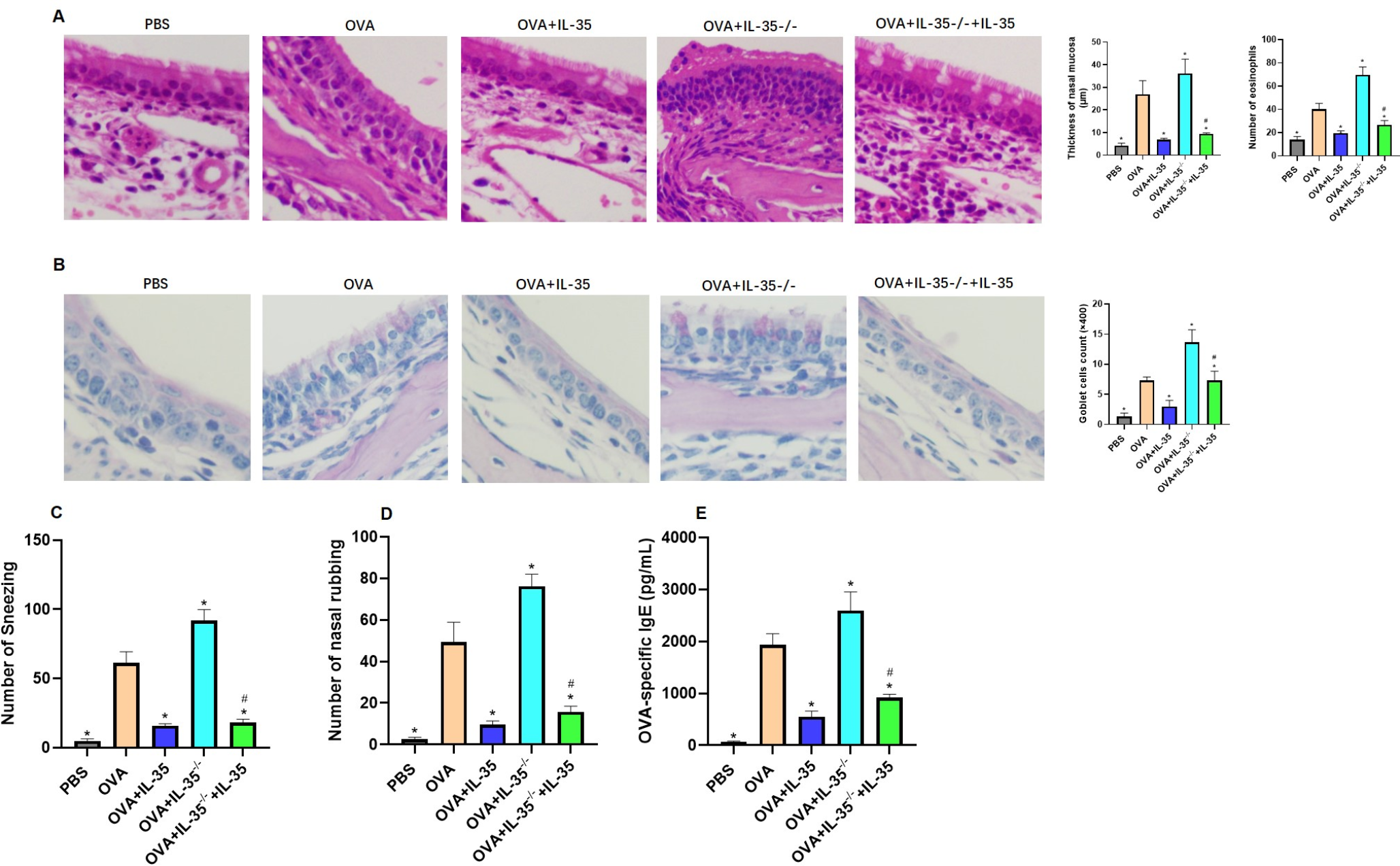 IL-35 modulates Tfh2 and Tfr cell balance to alleviate allergic rhinitis