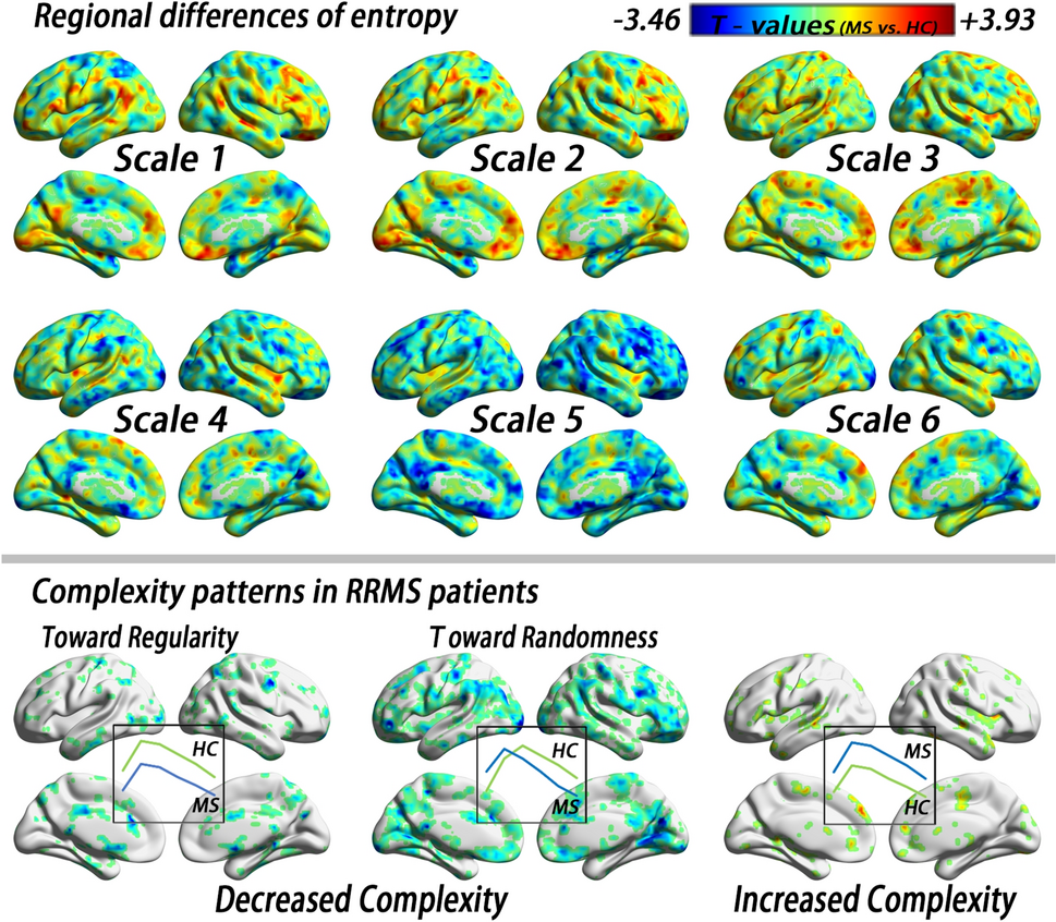 Complexity of intrinsic brain activity in relapsing–remitting multiple sclerosis patients: patterns, association with structural damage, and clinical disability