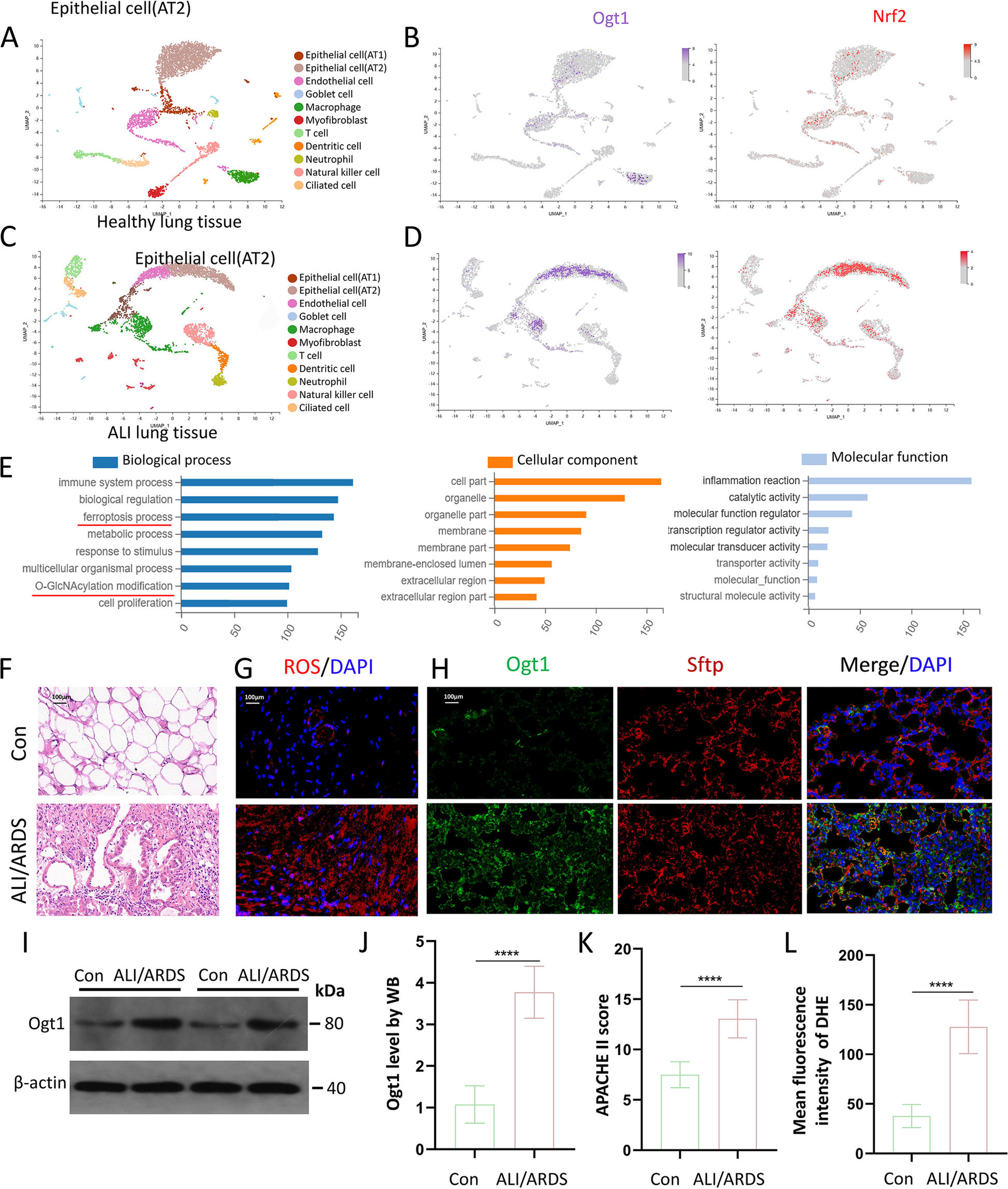 O-GlcNAcylation attenuates ischemia-reperfusion-induced pulmonary epithelial cell ferroptosis via the Nrf2/G6PDH pathway