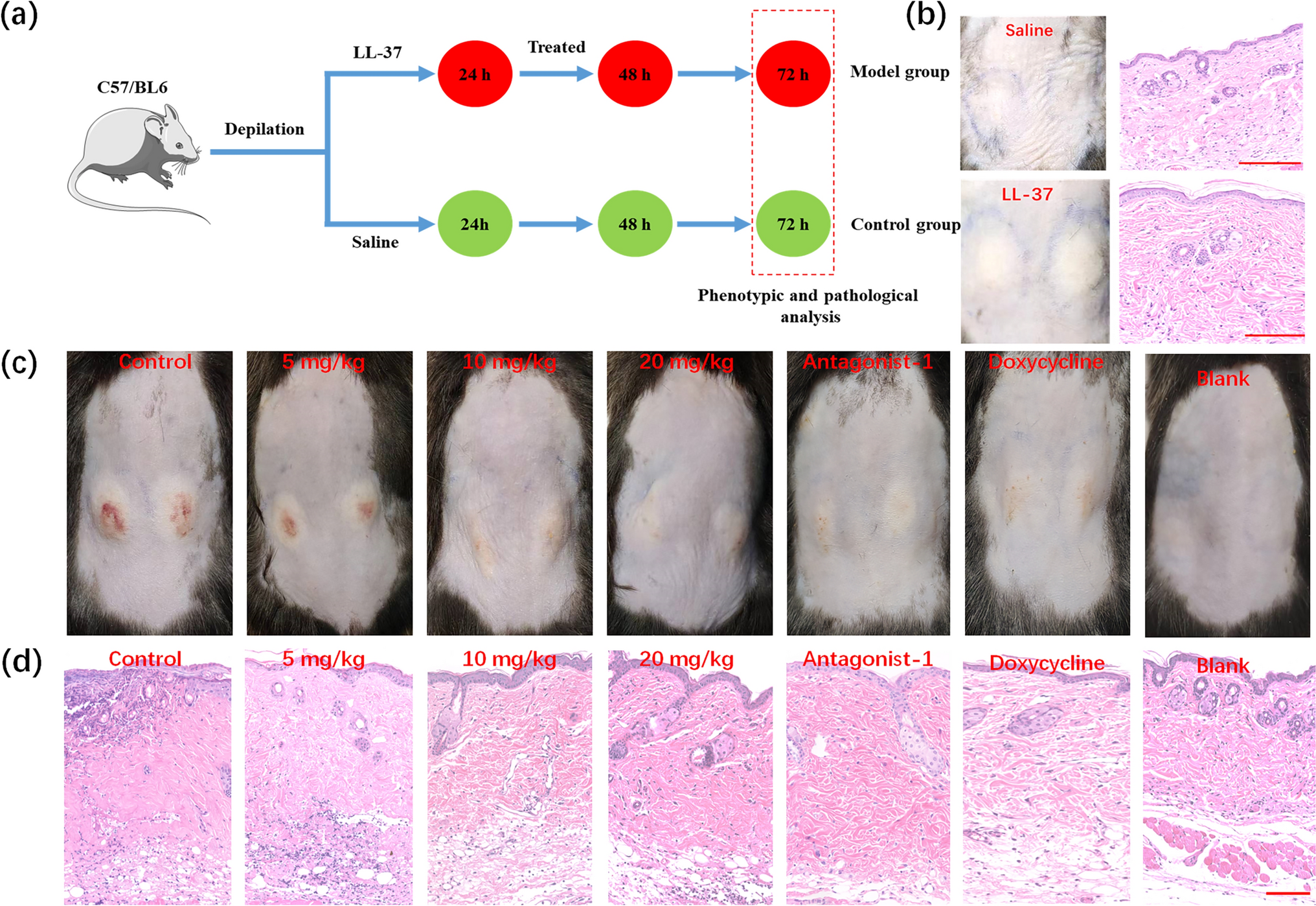 Casticin reduces rosacea-related inflammation by inhibiting mast cell activation via Mas-related G protein-coupled receptor X2