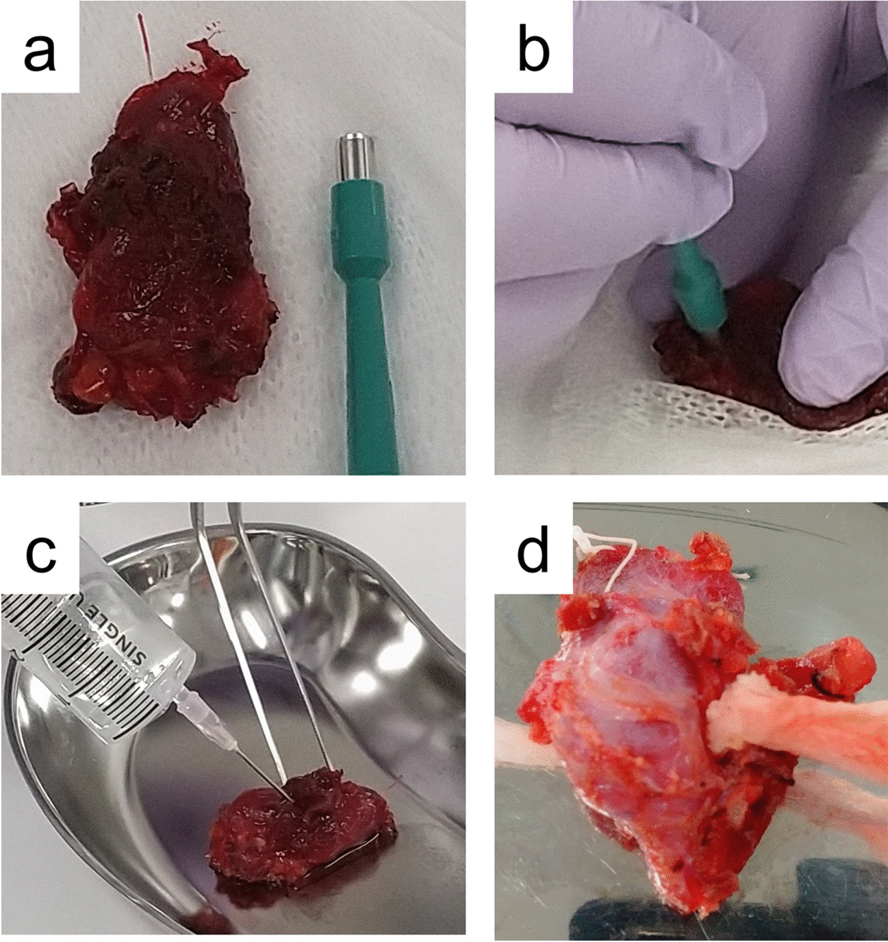 Effective Preparation of FFPE Tissue Samples for Preserving Appropriate Nucleic Acid Quality for Genomic Analysis in Thyroid Carcinoma