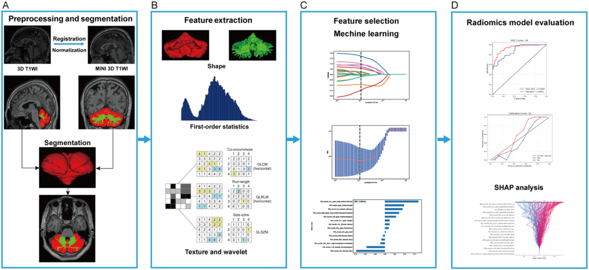 Radiomics-based Modelling Unveils Cerebellar Involvement in Parkinson’s Disease