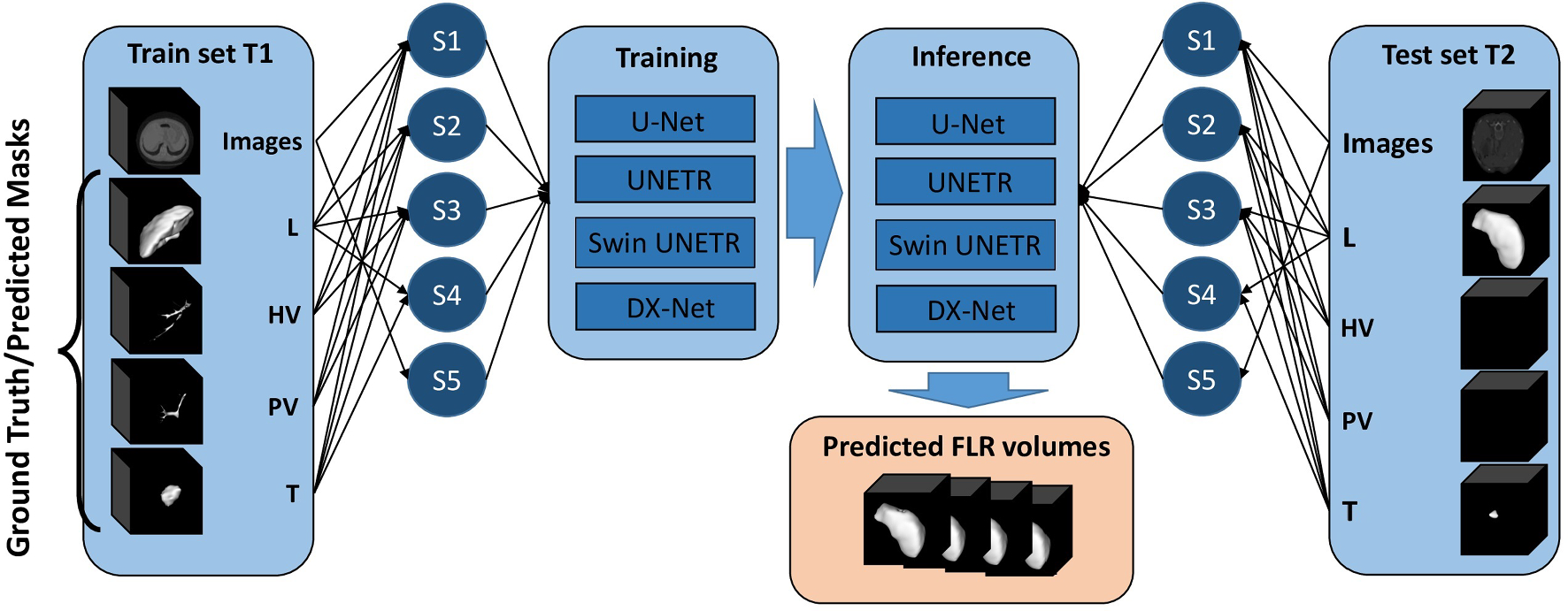 Automatic future remnant segmentation in liver resection planning