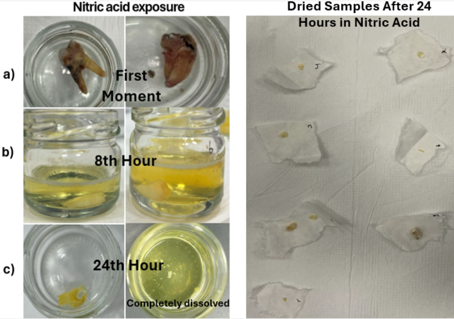 Determination of DNA recovery from human teeth exposed to various acids