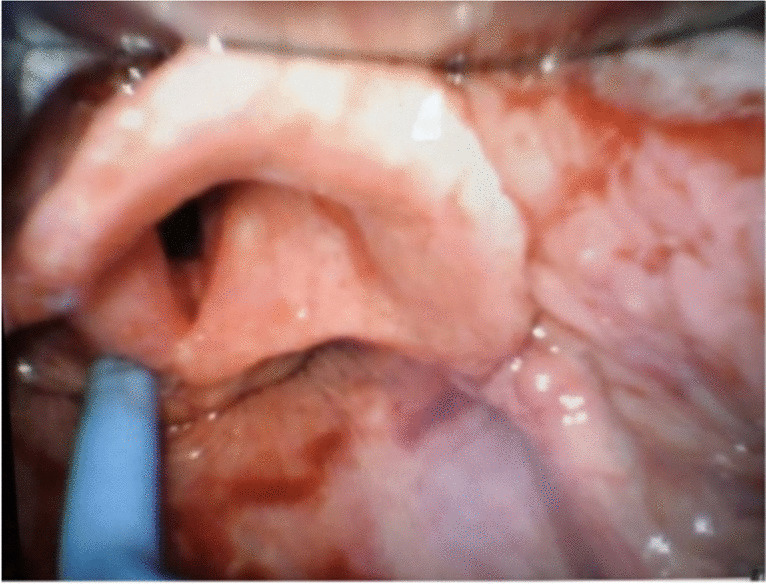 Pattern Recognition of Airway Management Barriers and Associated Troubleshooting Methods