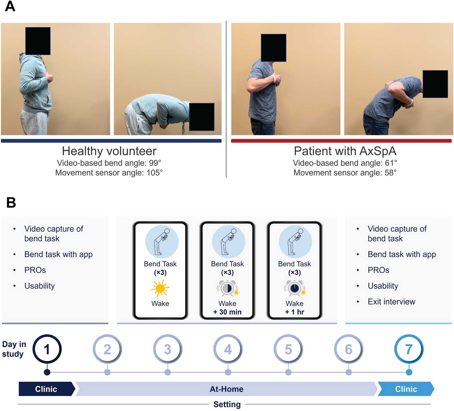 Clinical Validation and Outcome Measures From Bend Ease: A Novel, Sensor-Based Digital Measurement Tool for Assessing At-Home Morning Stiffness and Spinal Range of Motion in Axial Spondyloarthritis