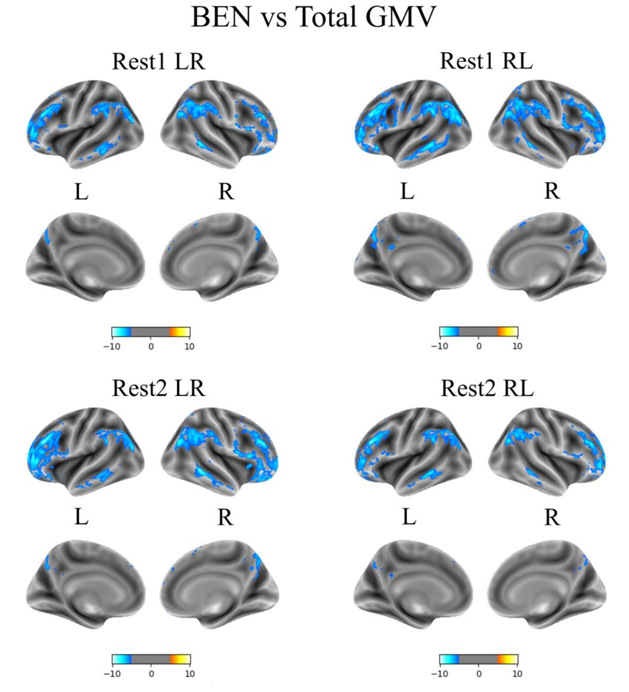 rsfMRI-based brain entropy is negatively correlated with gray matter volume and surface area