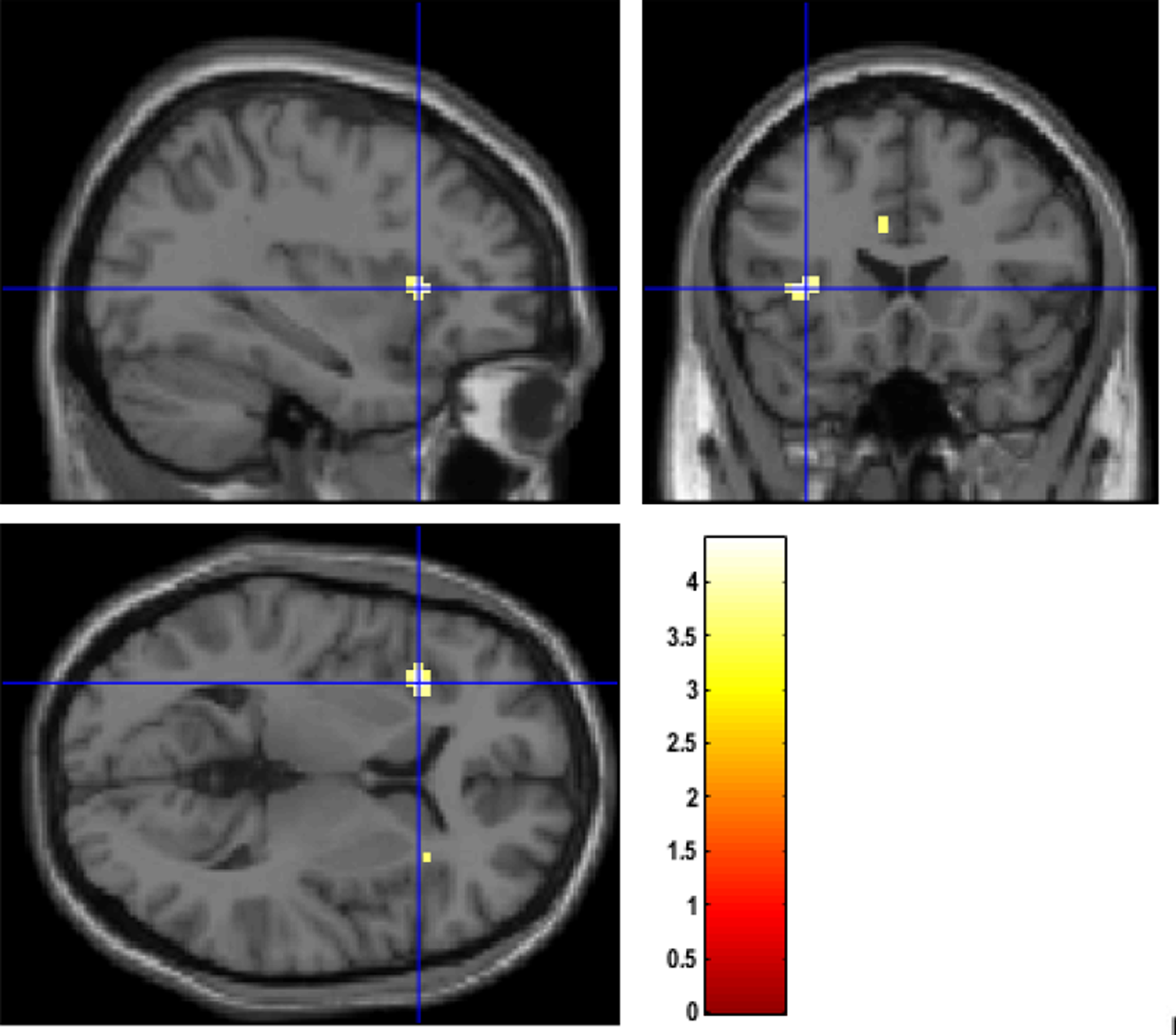 Multicomponent Multimethod Assessment of Emotional Change in Psychotherapy Research: Initial Validation of a Neurobehavioral Paradigm