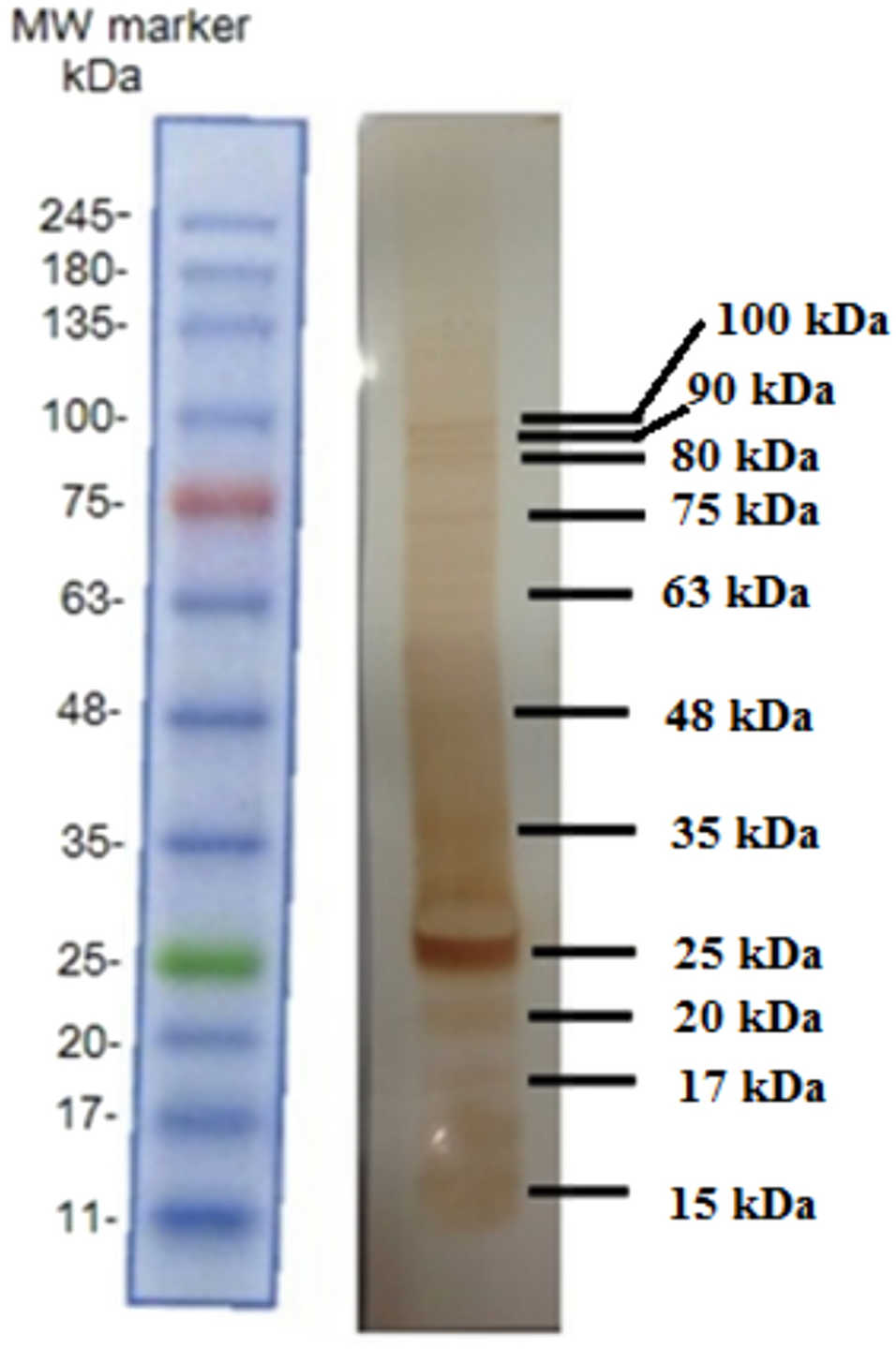 Production of recombinant electron transfer flavoprotein beta subunit protein and its application in a lateral flow assay for early diagnosis of leptospirosis
