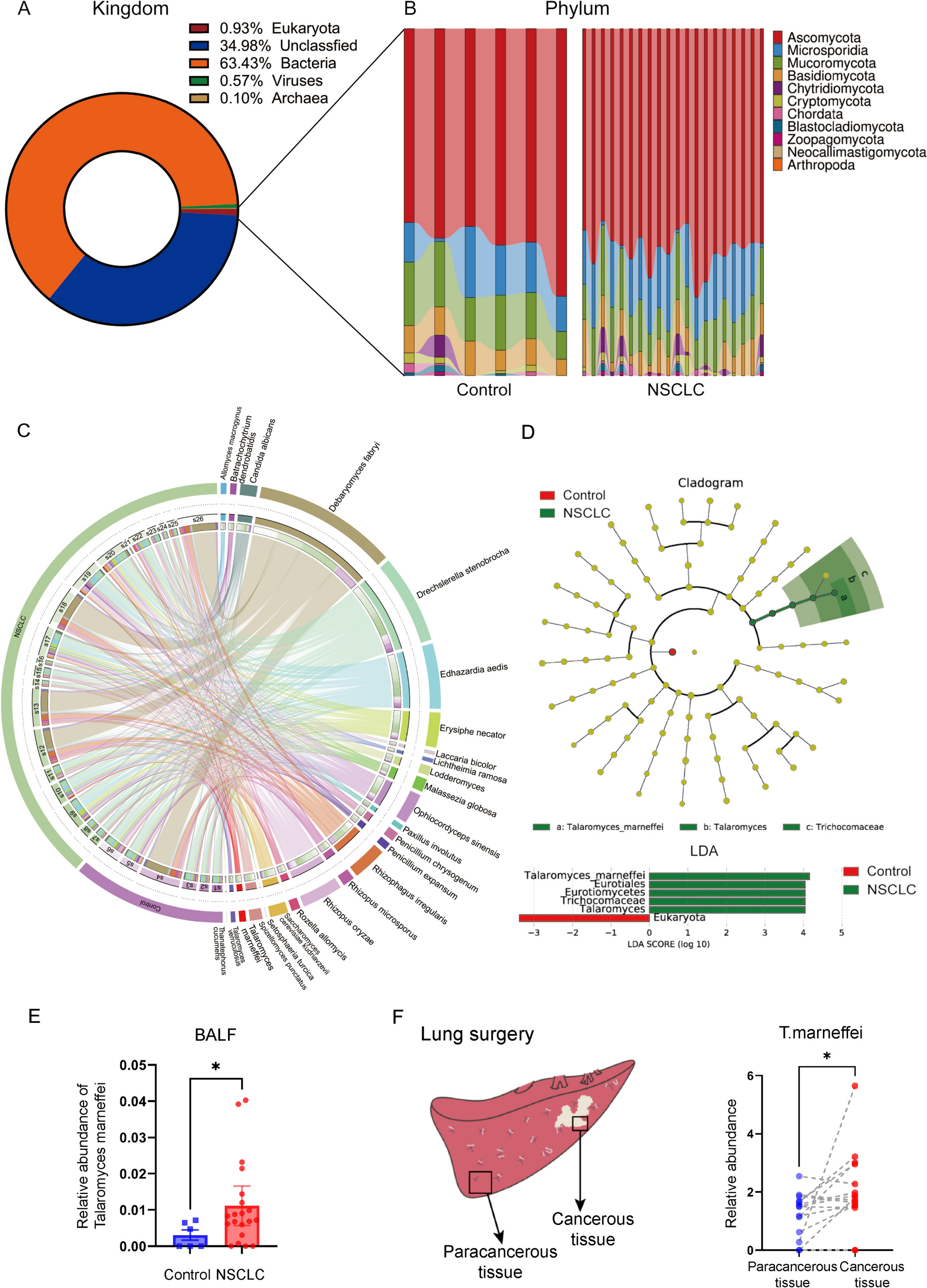 Dose-dependent M2 macrophage polarization induced by  promotes lung cancer cell growth via arginine-ornithine-cycle activation