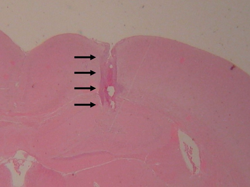Effects of Ingested Sulfite on Glutamate Synthesis and Release in the Rat Hippocampus