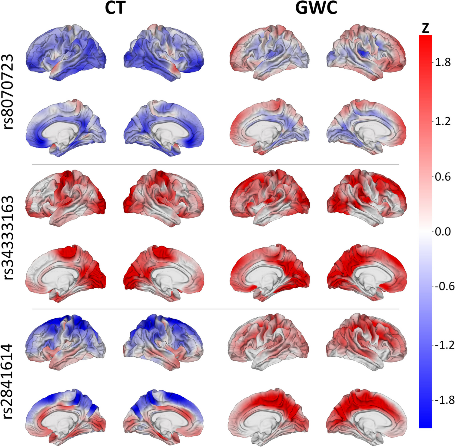 Genetic Insights into Brain Morphology: a Genome-Wide Association Study of Cortical Thickness and T-Weighted MRI Gray Matter-White Matter Intensity Contrast