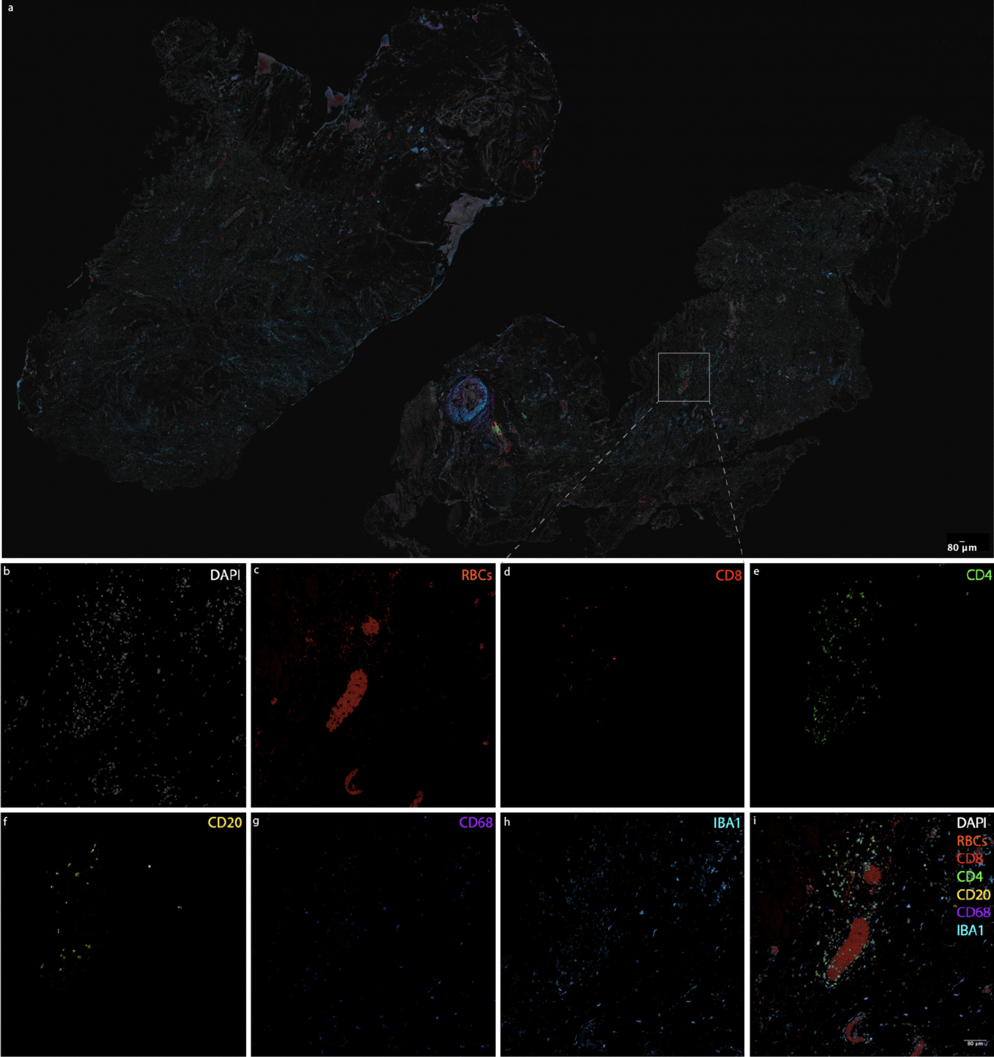 Optimizing Colocalized Cell Counting Using Automated and Semiautomated Methods