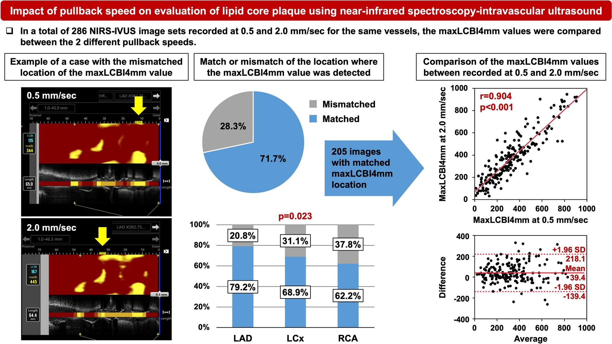Impact of pullback speed on evaluation of lipid core plaque using near-infrared spectroscopy-intravascular ultrasound
