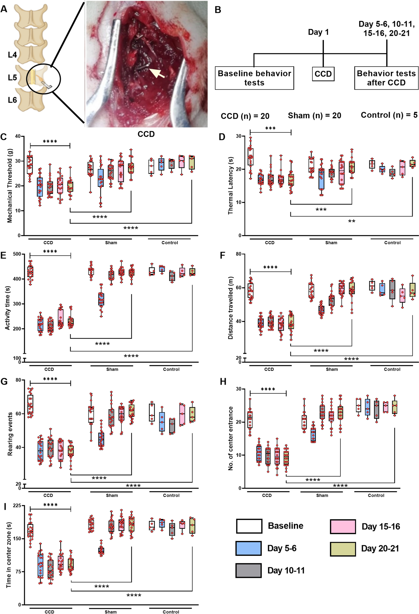 CaMKIIα-NpHR-Mediated Optogenetic Inhibition of DRG Glutamatergic Neurons by Flexible Optic Fiber Alleviates Chronic Neuropathic Pain