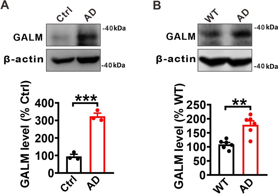 GALM Alleviates Aβ Pathology and Cognitive Deficit Through Increasing ADAM10 Maturation in a Mouse Model of Alzheimer’s Disease