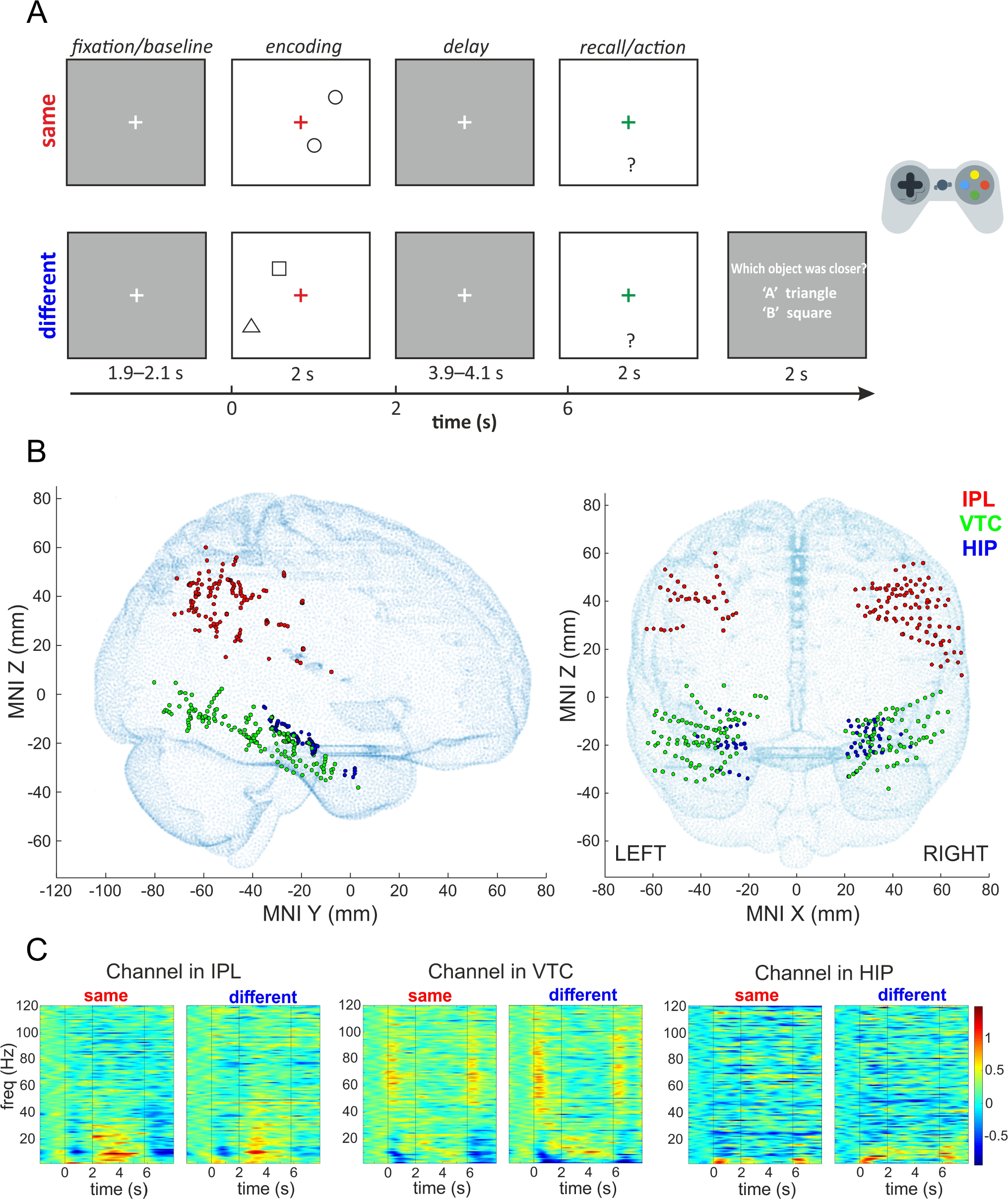 Neural Dynamics of Visual Stream Interactions During Memory-Guided Actions Investigated by Intracranial EEG