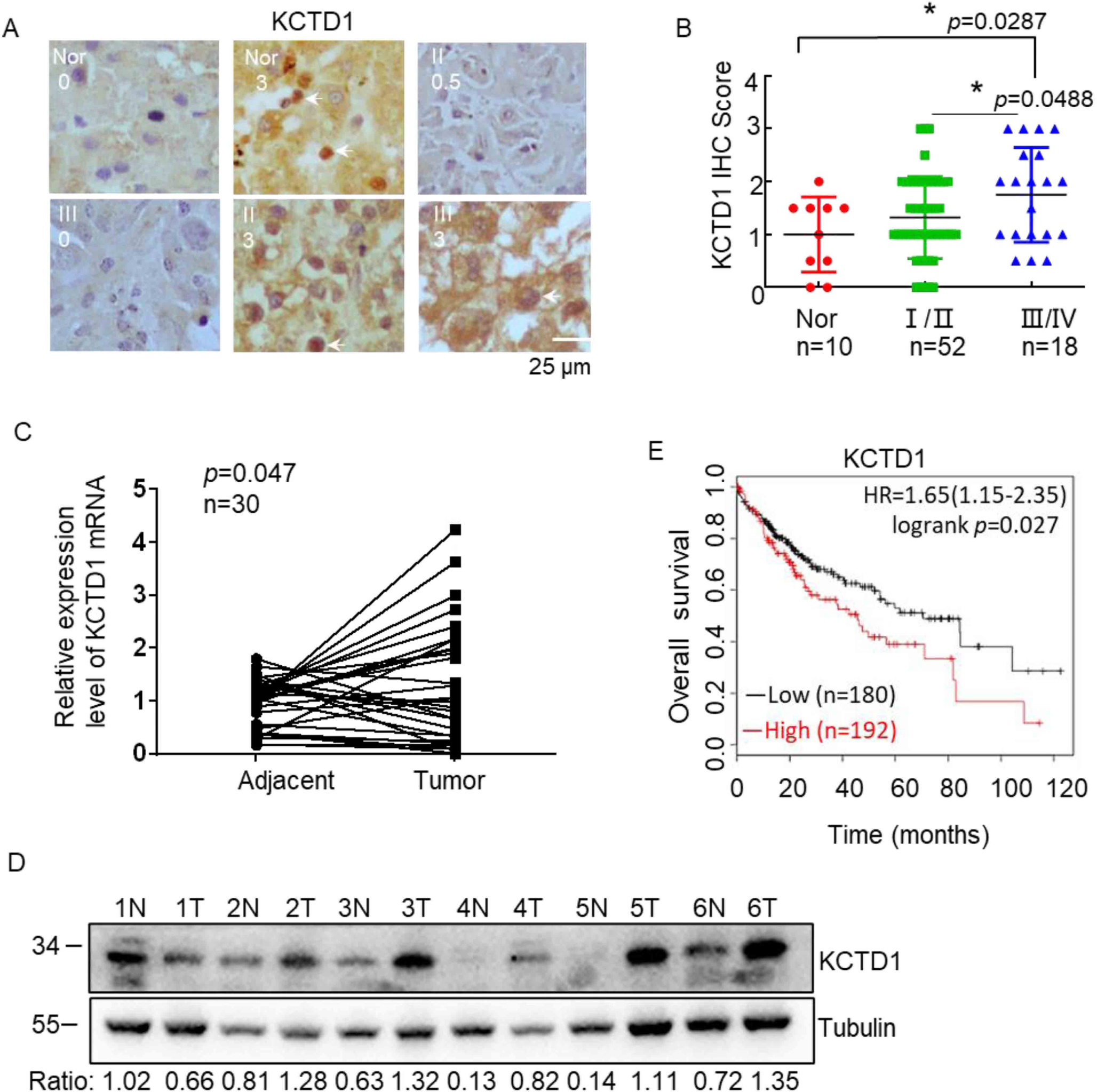 Exosomes delivering miR-129-5p combined with sorafenib ameliorate hepatocellular carcinoma progression via the KCTD1/HIF-1α/VEGF pathway