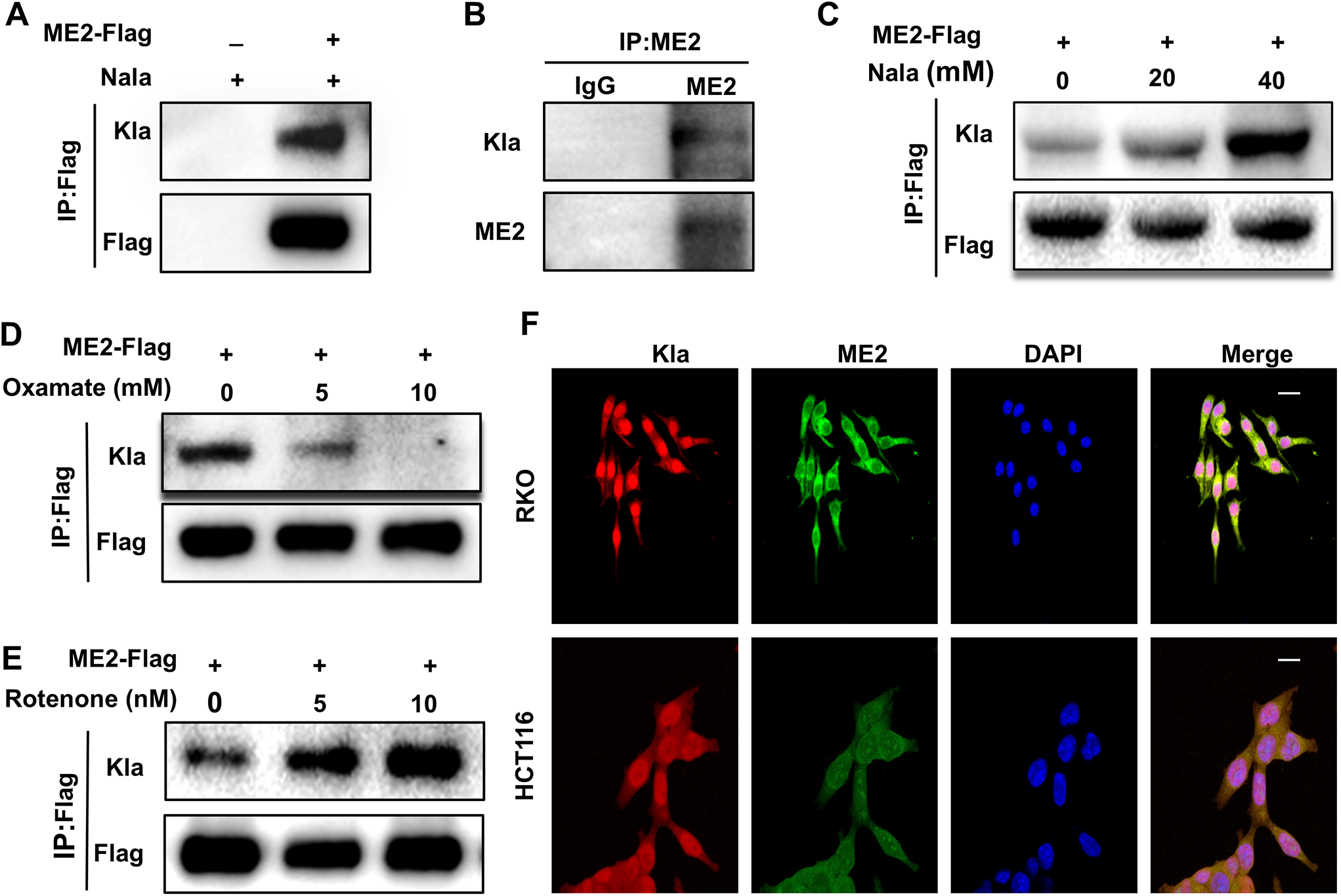 Sirtuin 3-mediated delactylation of malic enzyme 2 disrupts redox balance and inhibits colorectal cancer growth