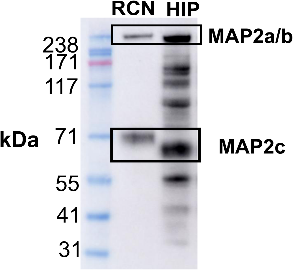 Exploring the potential role of microtubule associated proteins-2 in the pathogenesis of HIV associated neurocognitive disorders