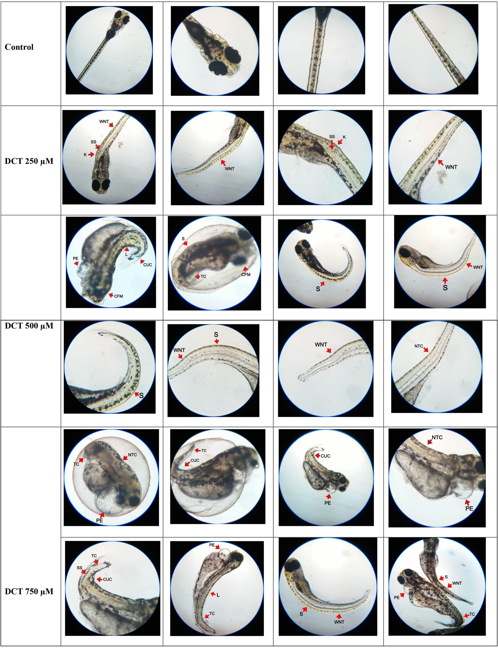 Protective Effect of -Inositol Against Decitabine-Induced Neural Tube Defects in Embryonic Zebrafish