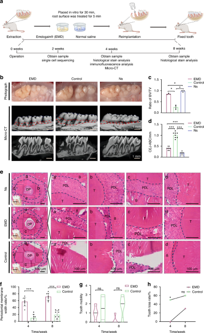Single-cell sequencing systematically analyzed the mechanism of Emdogain on the restoration of delayed replantation periodontal membrane