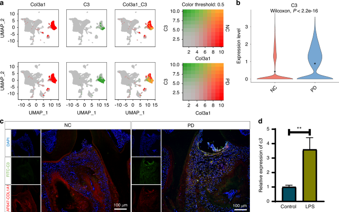 Fibroblast derived C3 promotes the progression of experimental periodontitis through macrophage M1 polarization and osteoclast differentiation