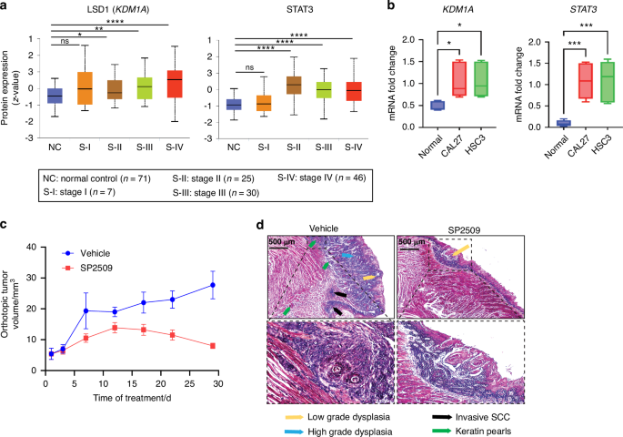 Lysine-specific demethylase 1 controls key OSCC preneoplasia inducer STAT3 through CDK7 phosphorylation during oncogenic progression and immunosuppression