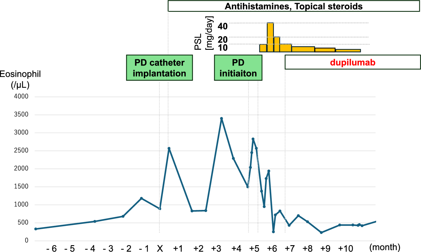 A case of systemic contact dermatitis associated with a peritoneal dialysis catheter and treated with dupilumab