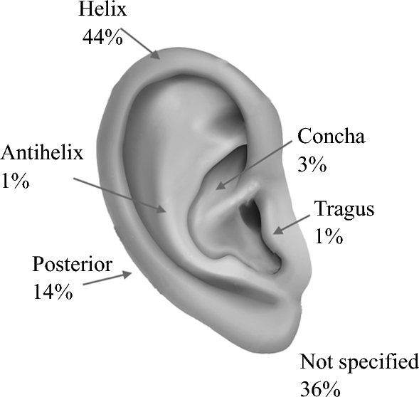 Cartilage Resection in the Surgical Management of Ear Melanoma