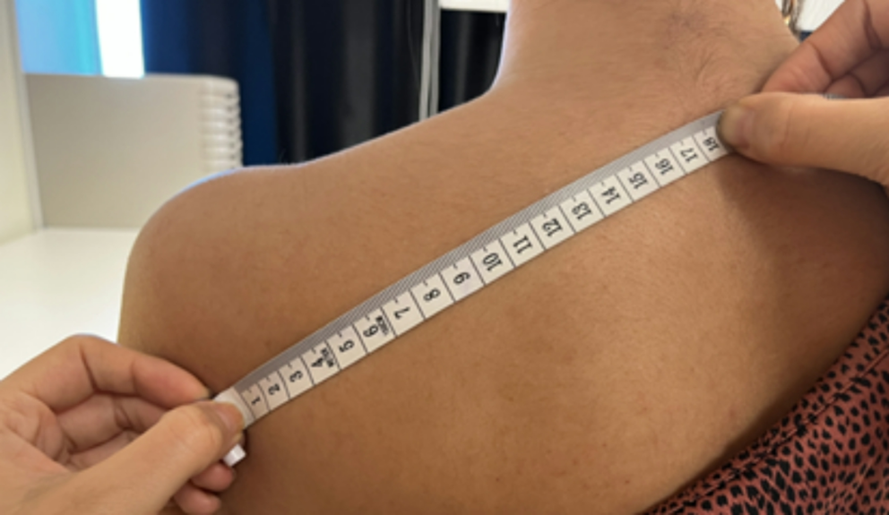 Structural changes in the upper trapezius muscle of fibromyalgia patients identified by quantitative ultrasonography: a cross-sectional study