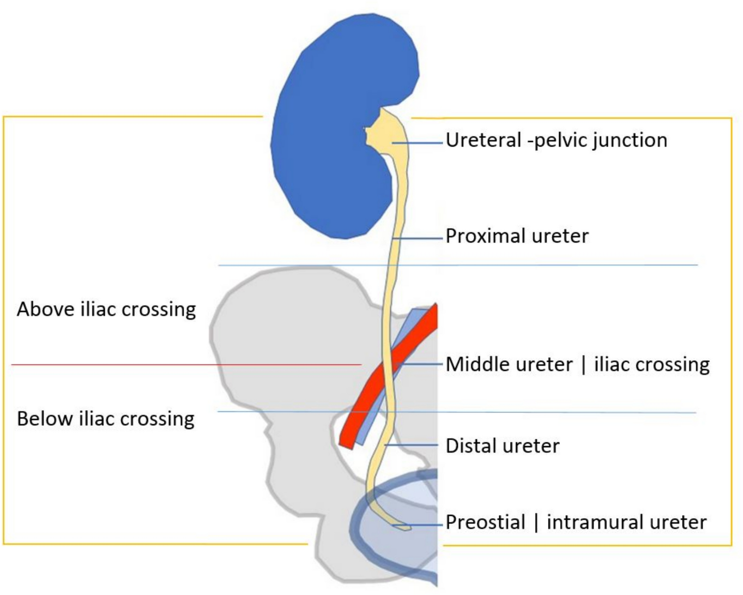 Prediction for spontaneous passage of ureteral stones with indwelling ureteral stent: PASS score