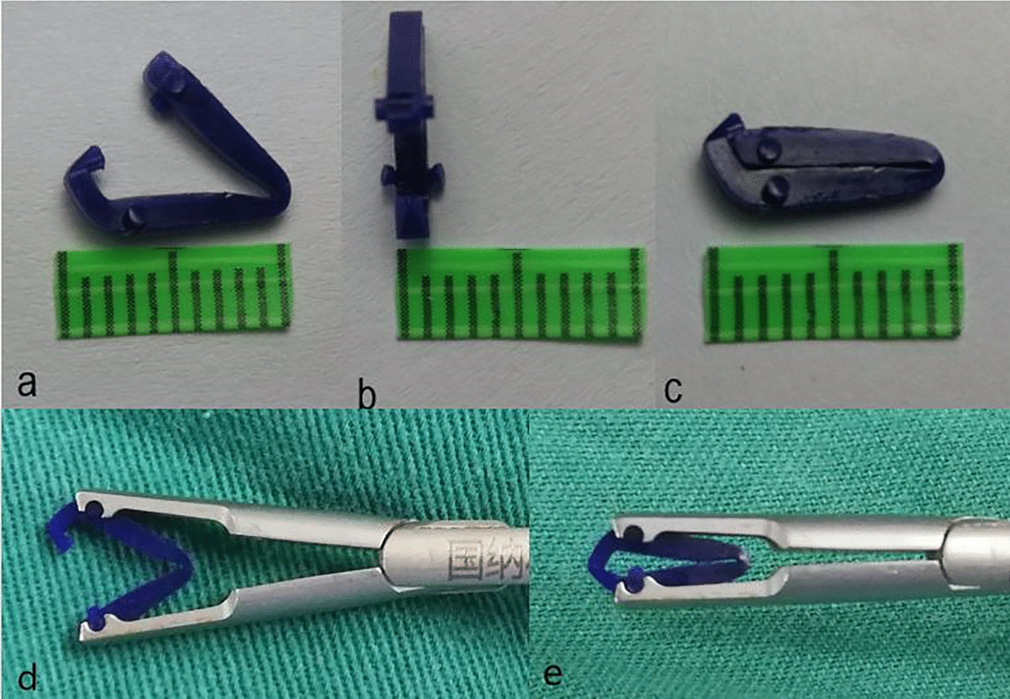Absorbable Clips Applied in Thoracoscopic Anatomical Lung Resection in Younger Children