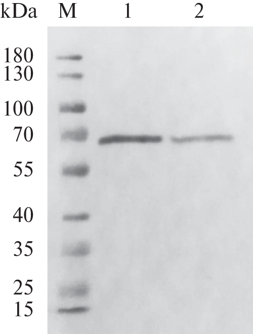 Rare Forms of Vitamin D-Binding Protein (DBP): Analytical Literature Review