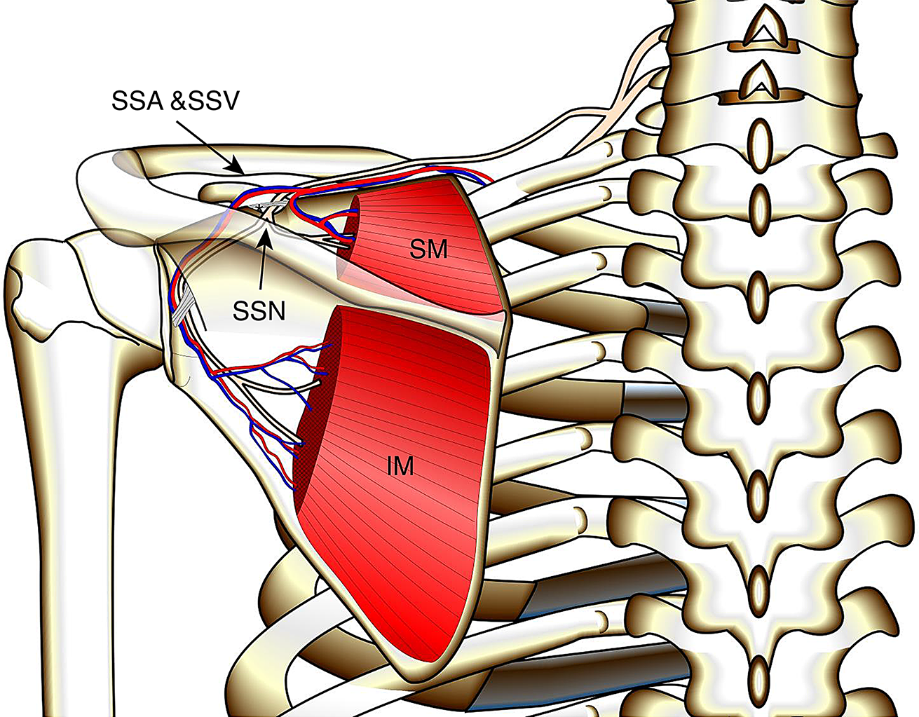 Variation in morphology of the suprascapular nerve and vessels at the suprascapular notch: clinical implications for suprascapular nerve release