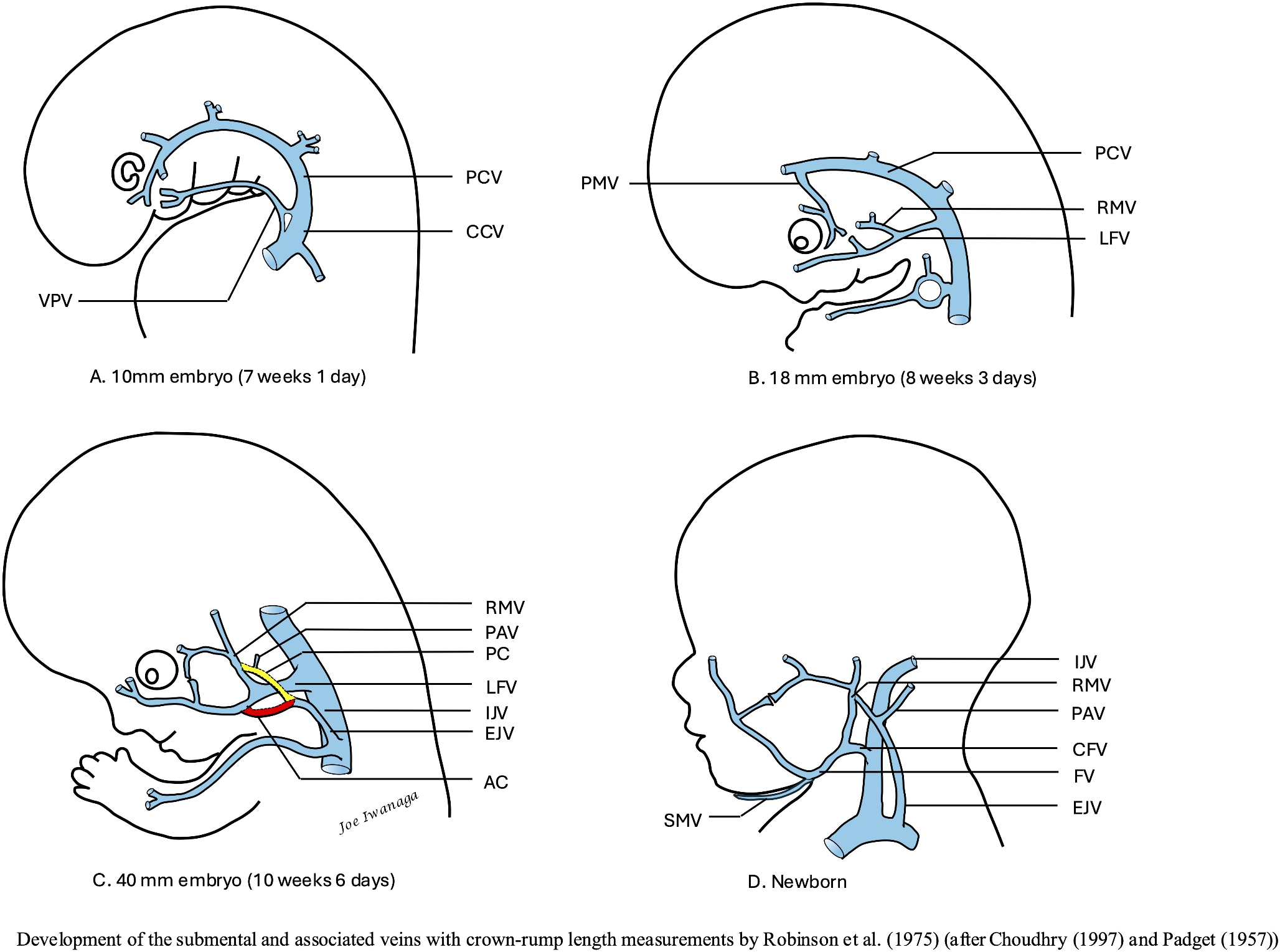 Clinical anatomy of the submental vein