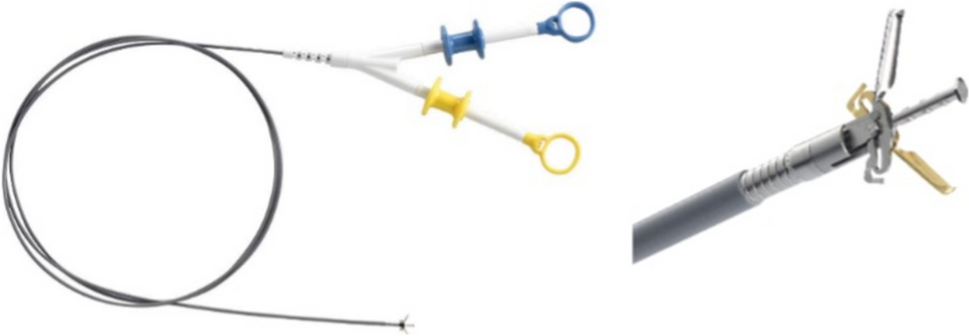 Pilot study of metallic clip-assisted through-the-scope twin clip technique for defect closure after endoscopic full-thickness resection of small gastric subepithelial tumors