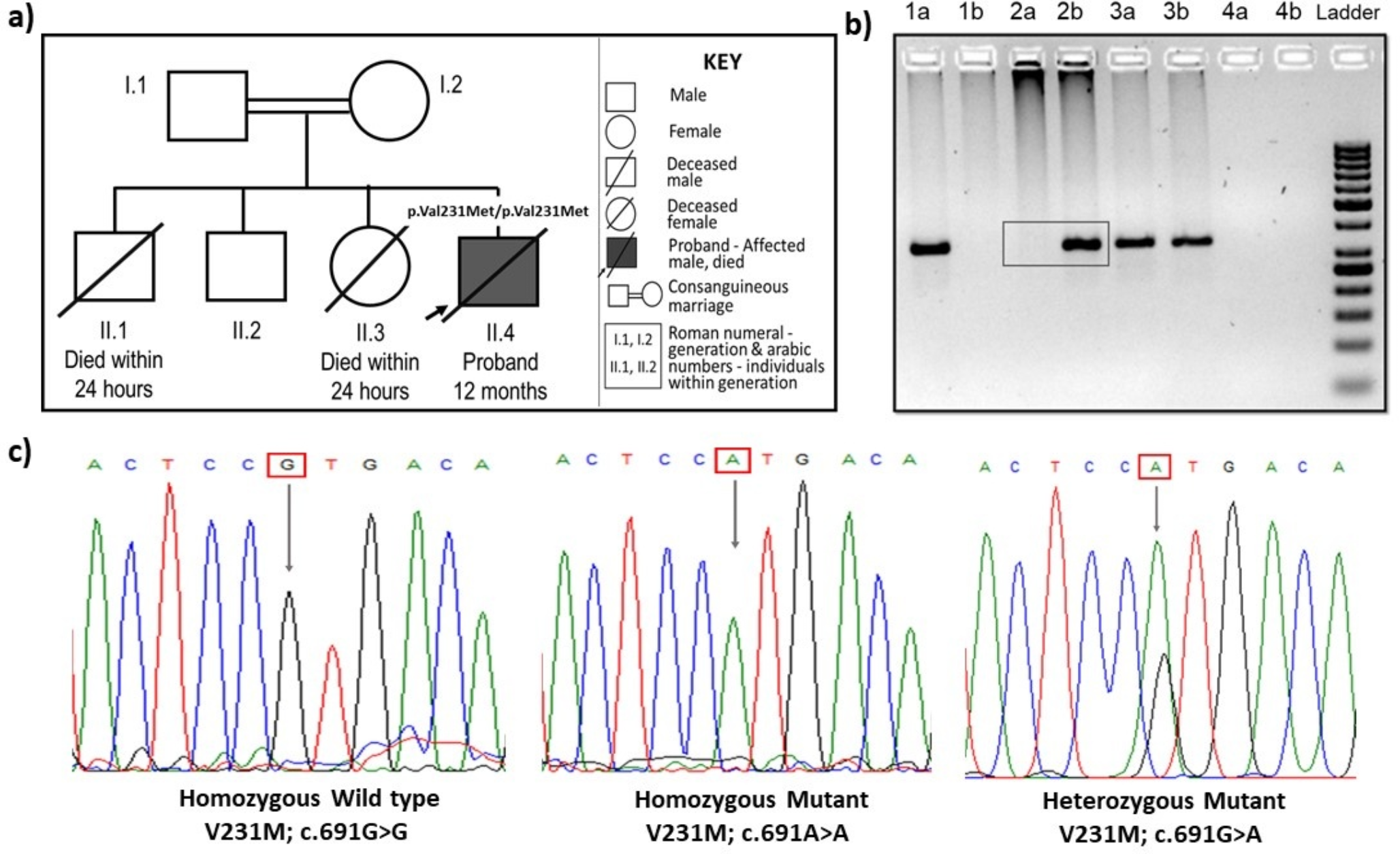 Clinical, Biochemical and Molecular Findings of Two PMM2-CDG Cases from India