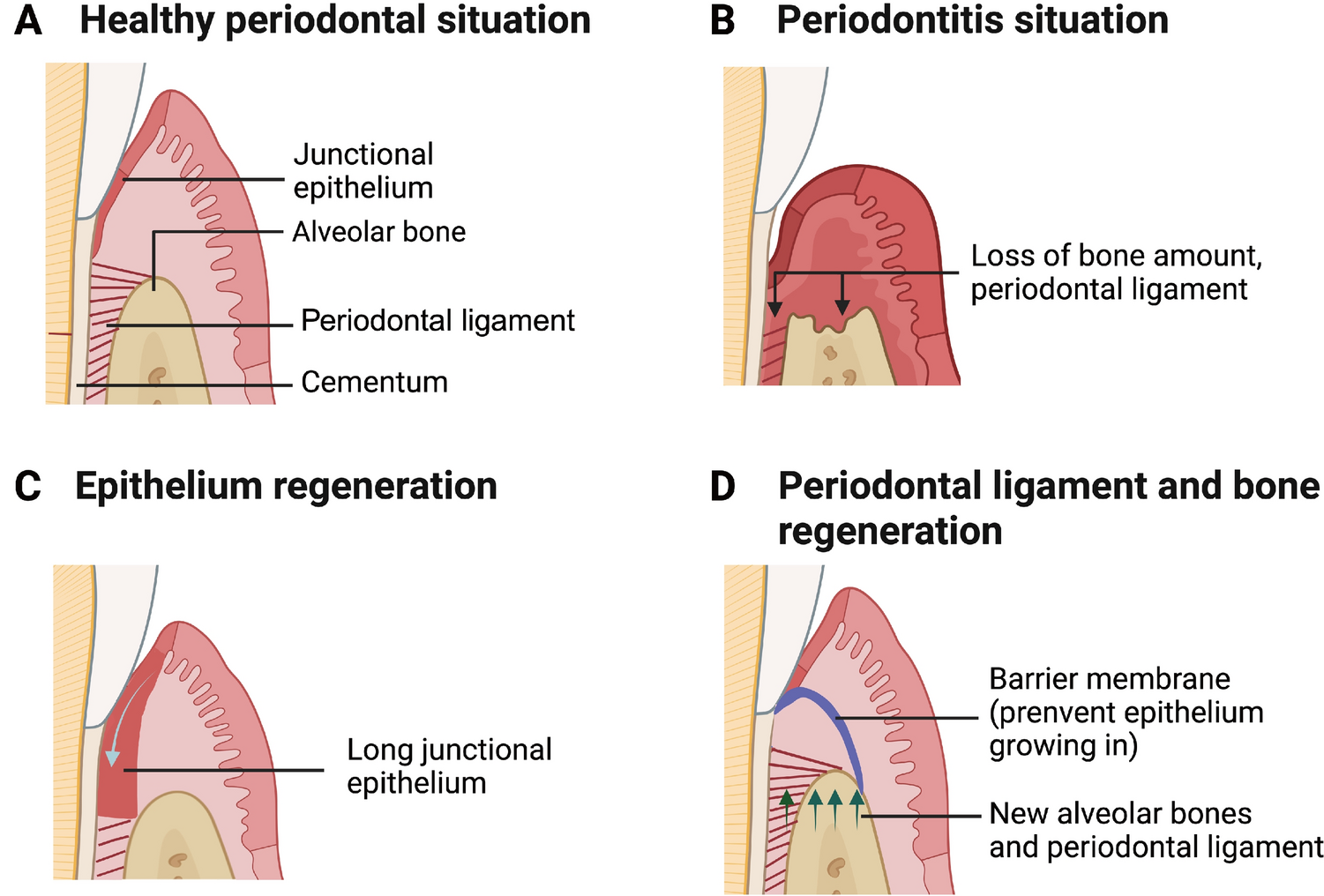 Implantable Dental Barrier Membranes as Regenerative Medicine in Dentistry: A Comprehensive Review