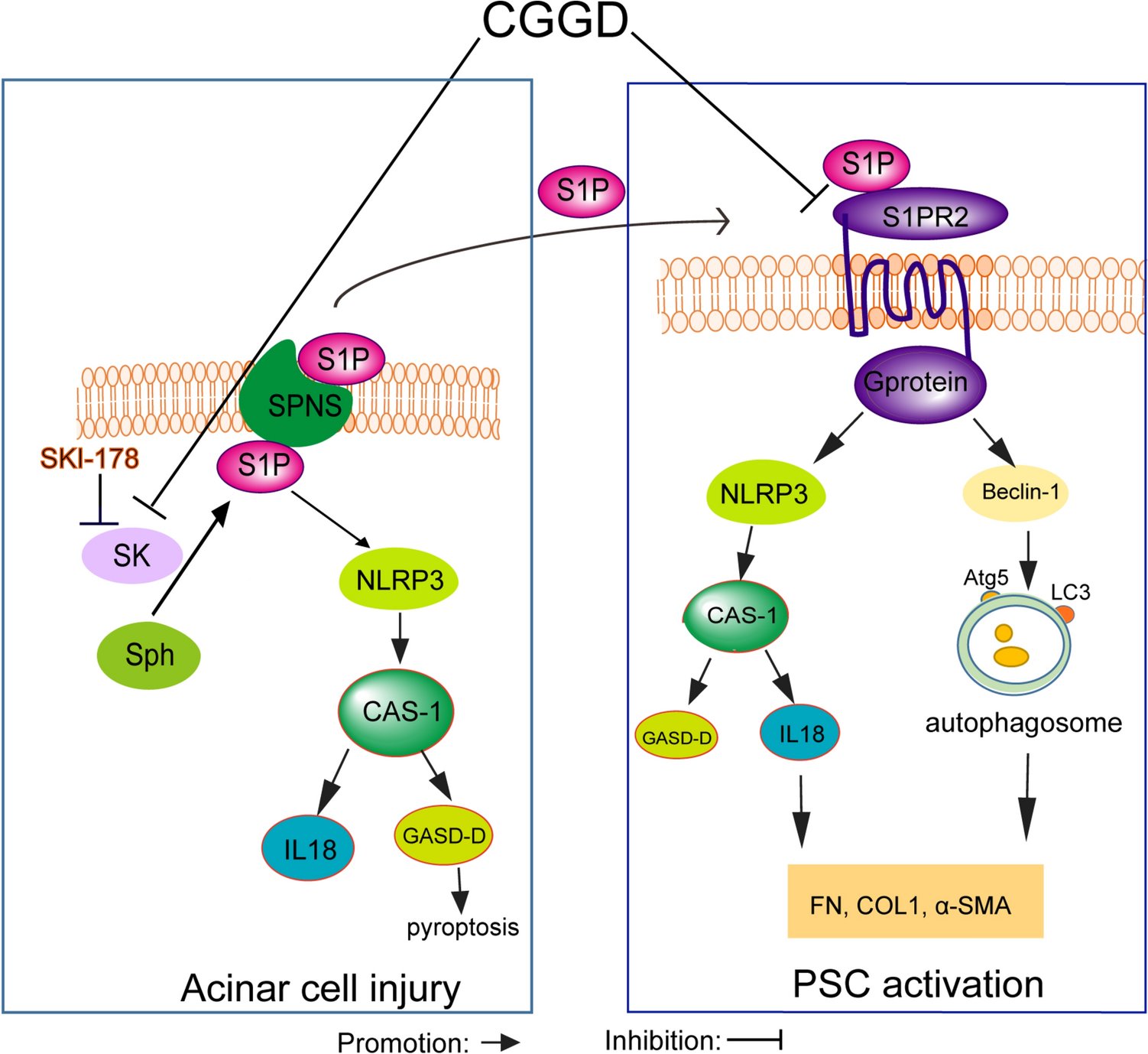 Chaihu Guizhi Ganjiang Decoction ameliorates chronic pancreatitis by modulating the SK1/S1P signaling pathway