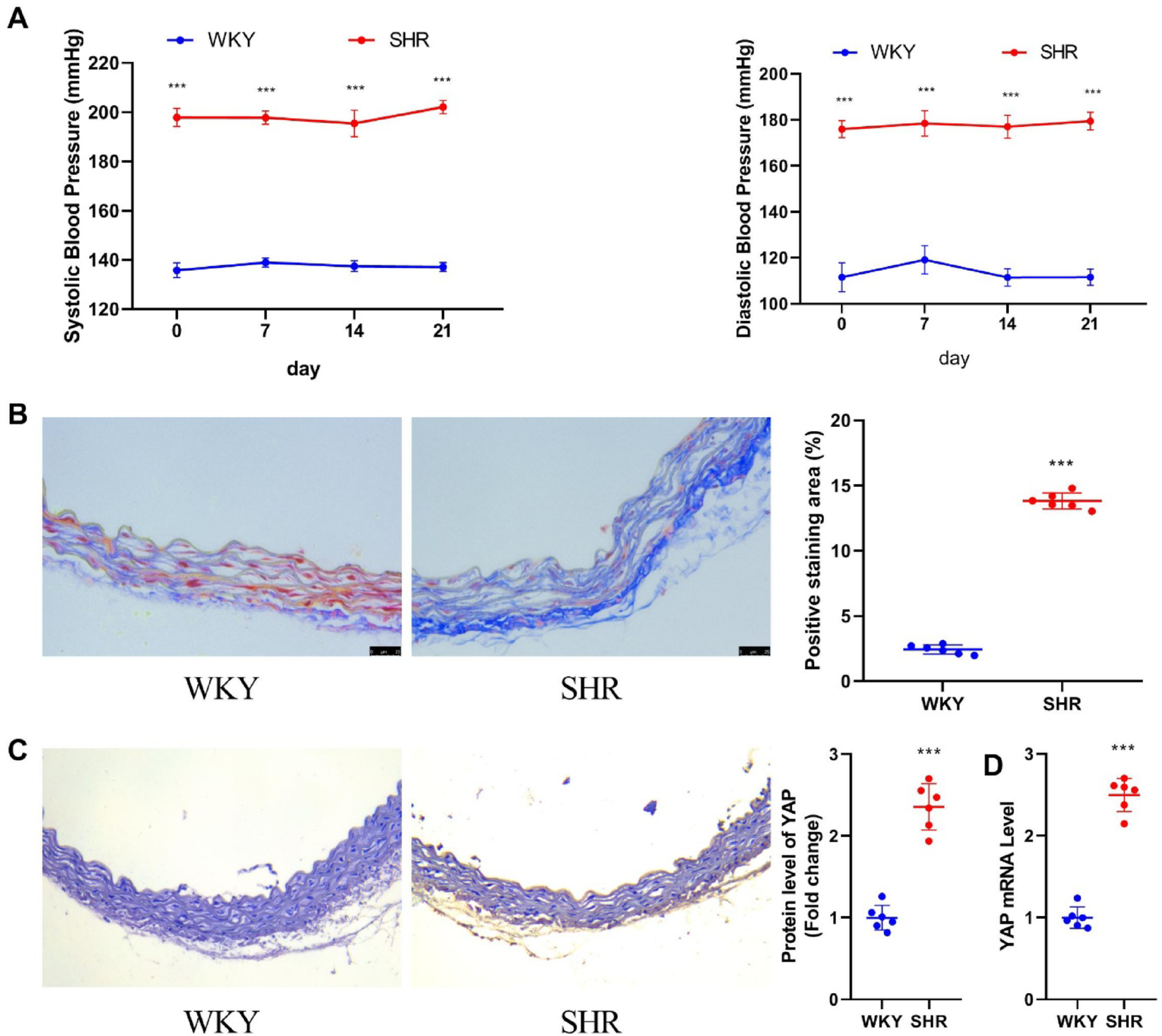 Activation of Hippo/YAP signaling pathway exacerbates vascular remodeling and aggravates hypertension by upregulating Foxm1