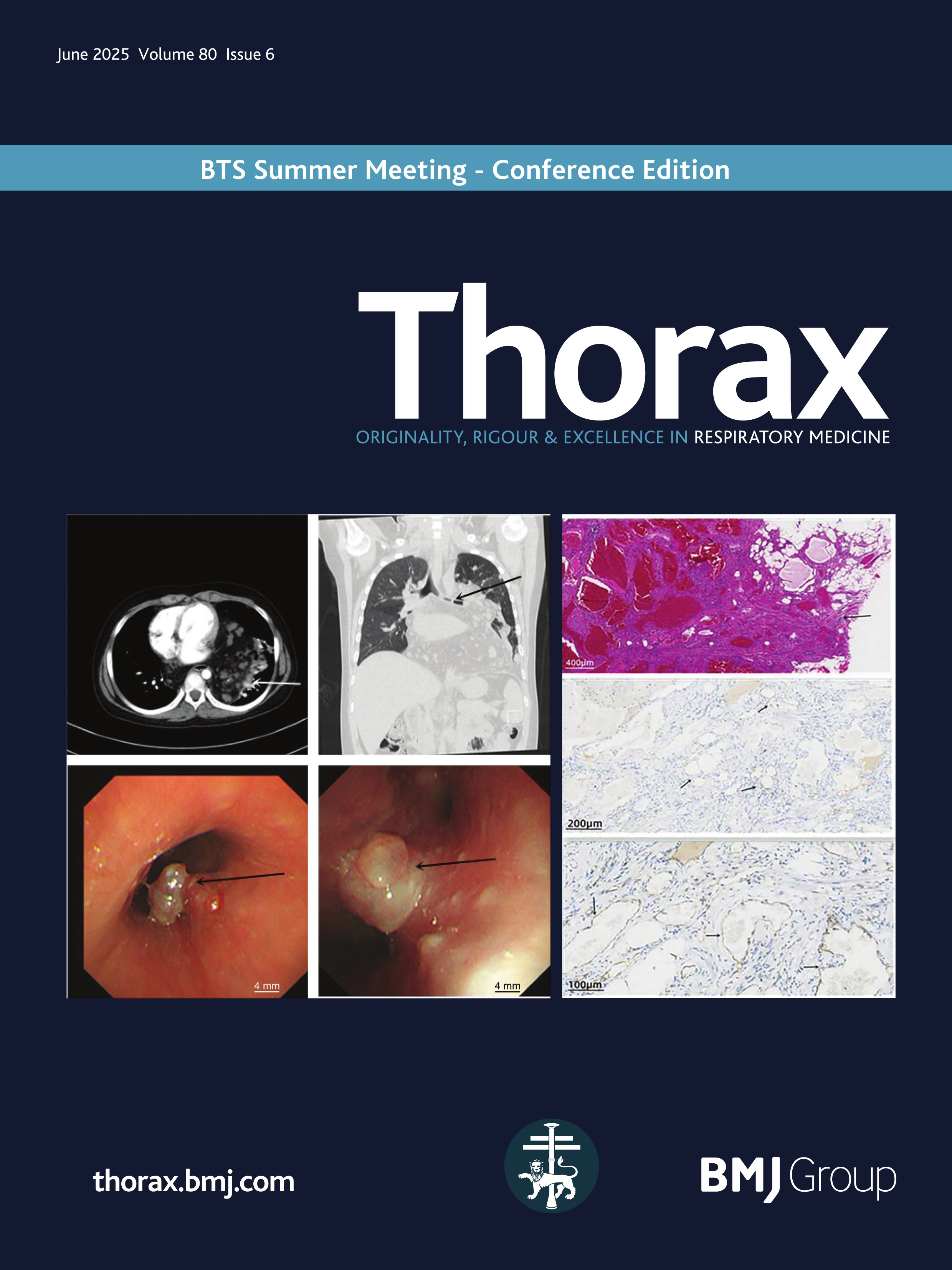 Effect of time of day and seasonal variation on bronchodilator responsiveness: the SPIRO-TIMETRY study