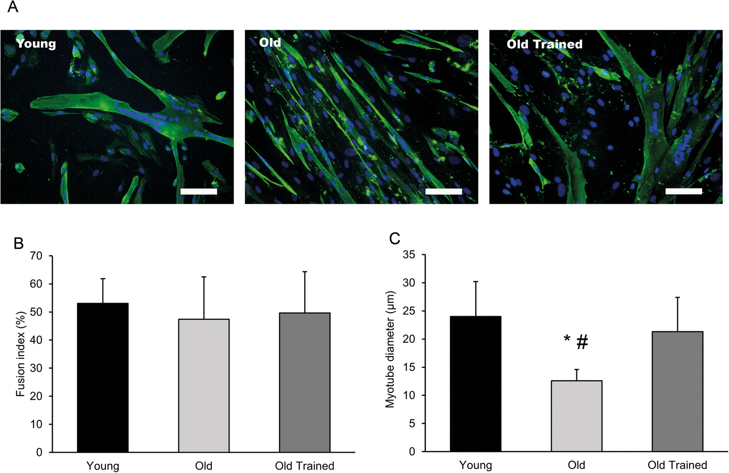 mTORC1 signalling and protein synthesis are elevated in response to amino acids in human myotubes obtained from young, old, and old trained men