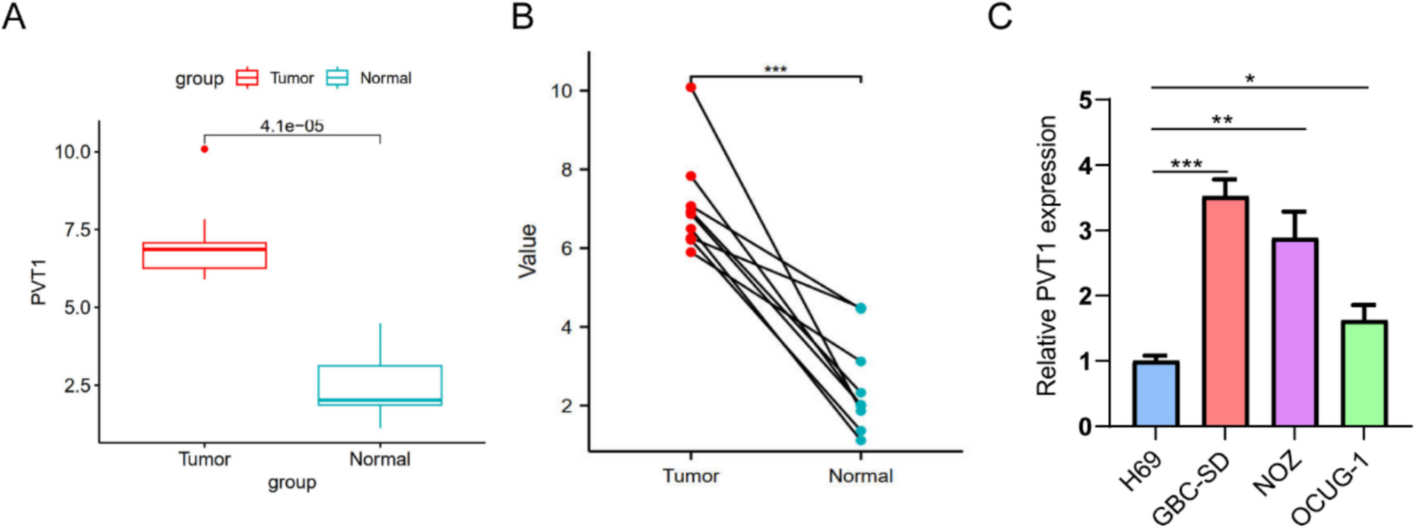 LncRNA  promotes proliferation and migration in gallbladder adenocarcinoma by modulating / axis