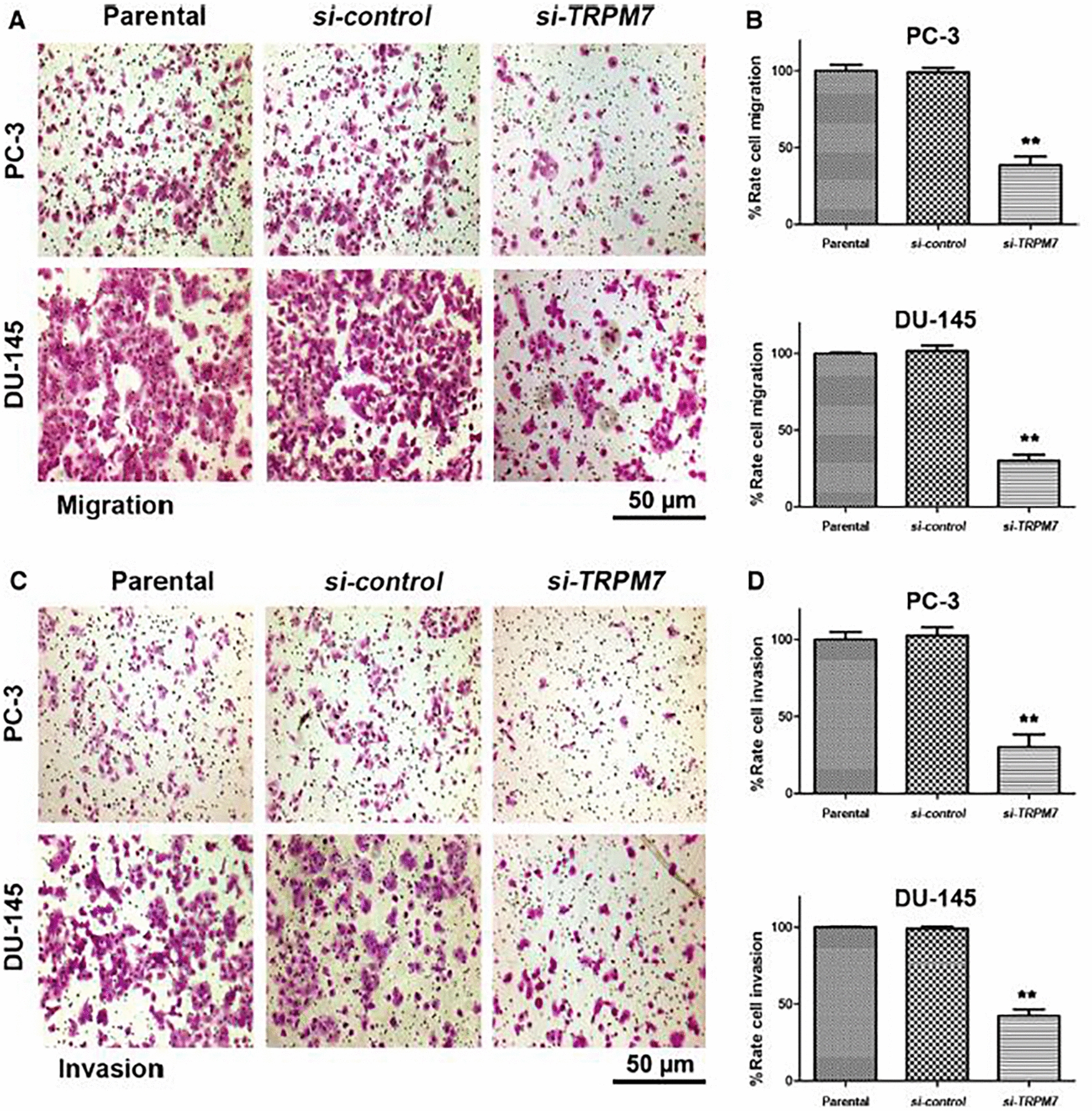 Correction to: Downregulation of  suppressed migration and invasion by regulating epithelial–mesenchymal transition in prostate cancer cells