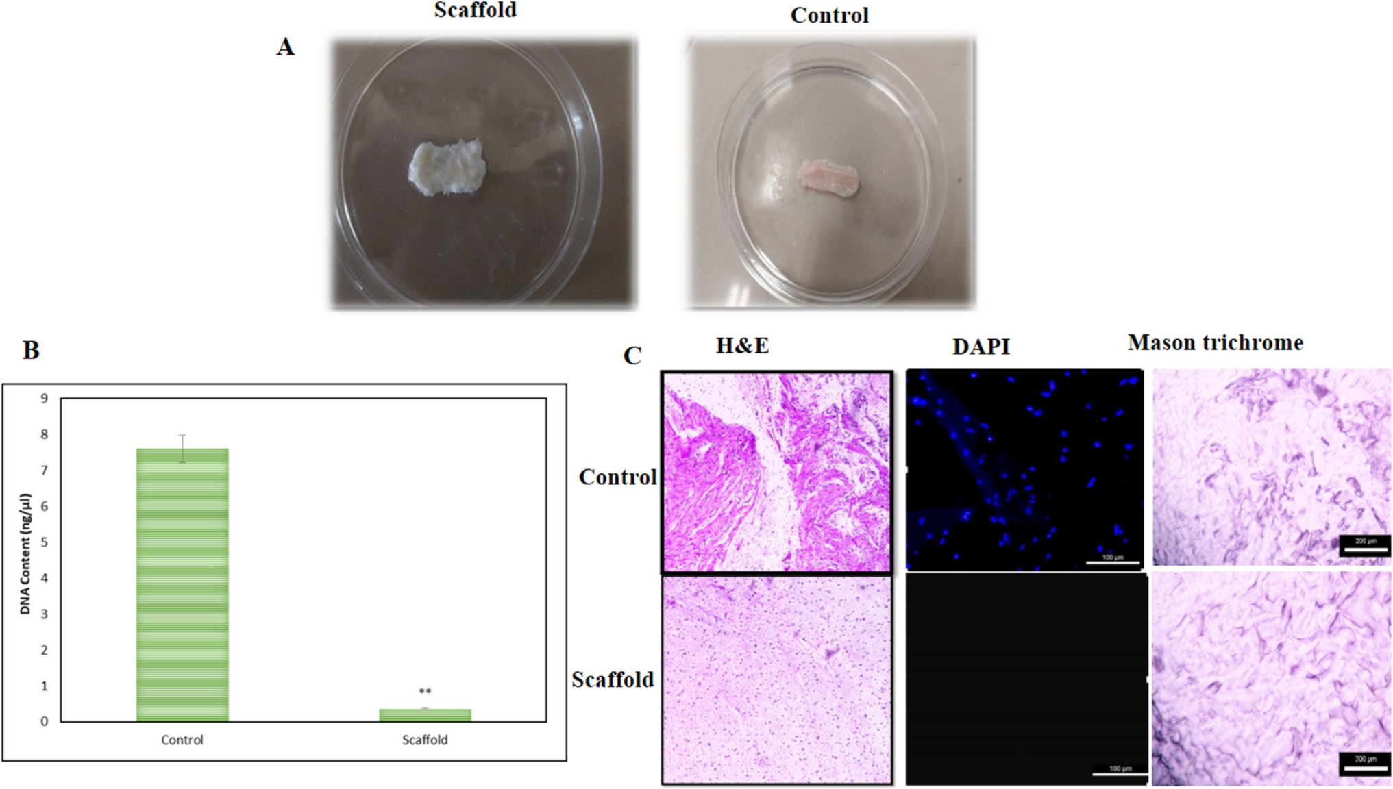 Development and Characterization of Decellularized Sheep Ureter Scaffolds for Cell-Based Tissue Engineering